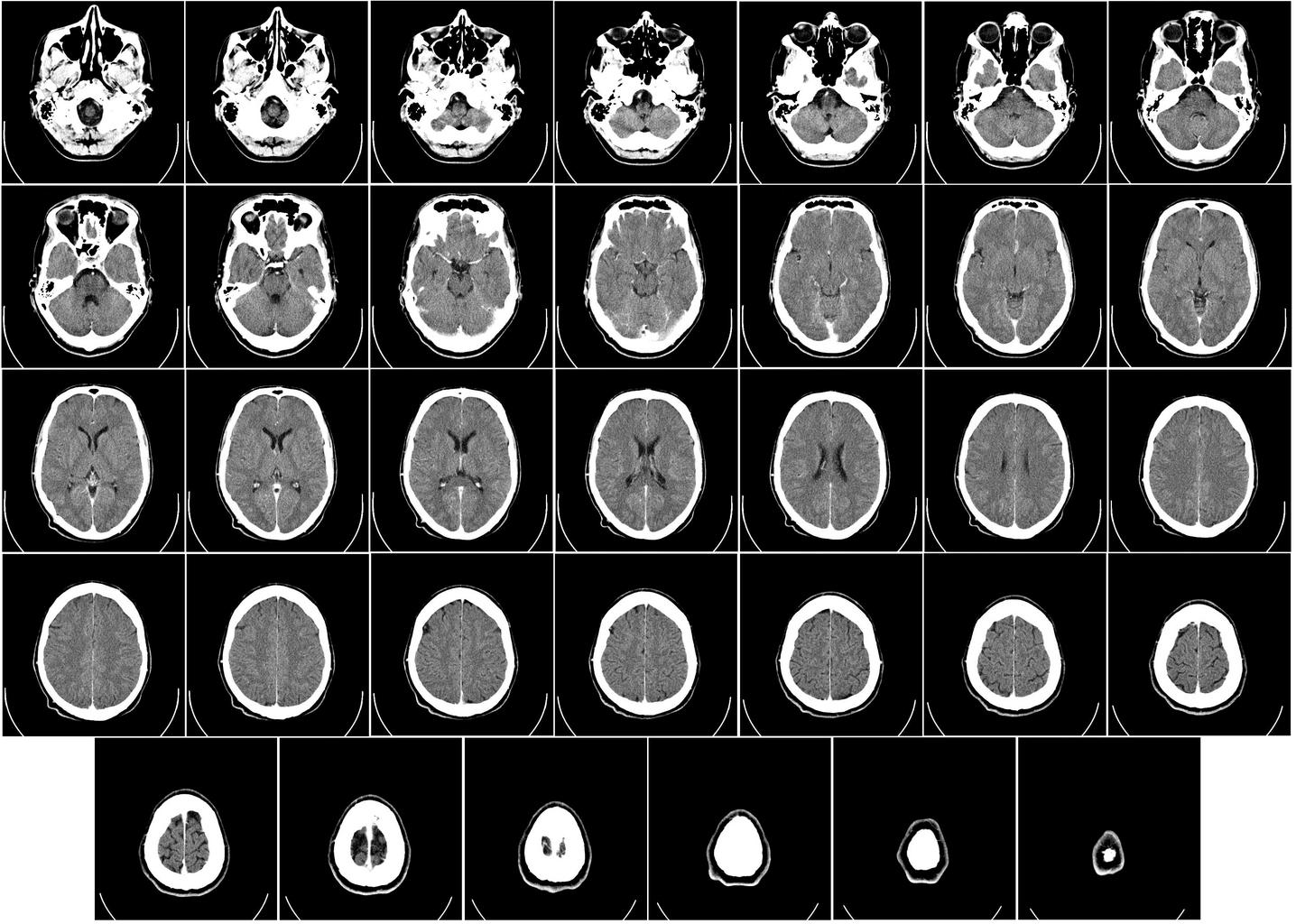 Neurologist