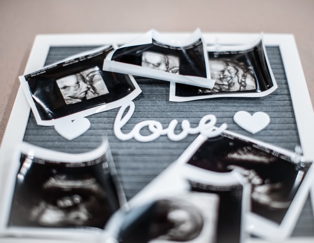 ultrasound photos